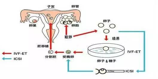 广州捐卵公司